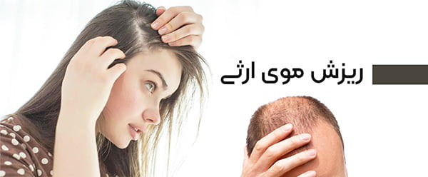 عوامل ژنتیکی و ارثی در ریزش موی سر